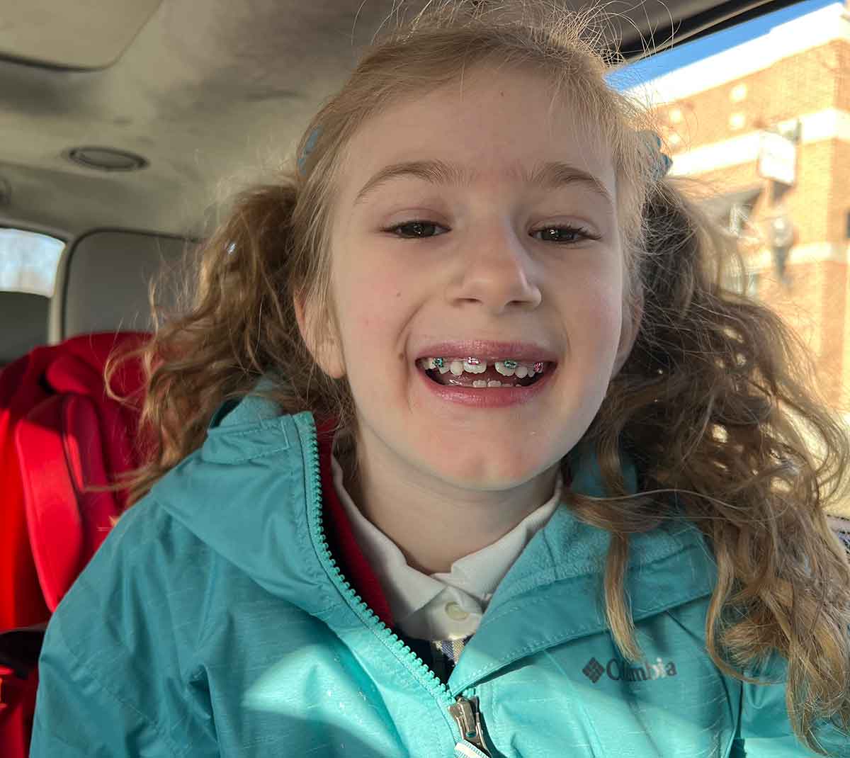 Little girl smiling with braces.