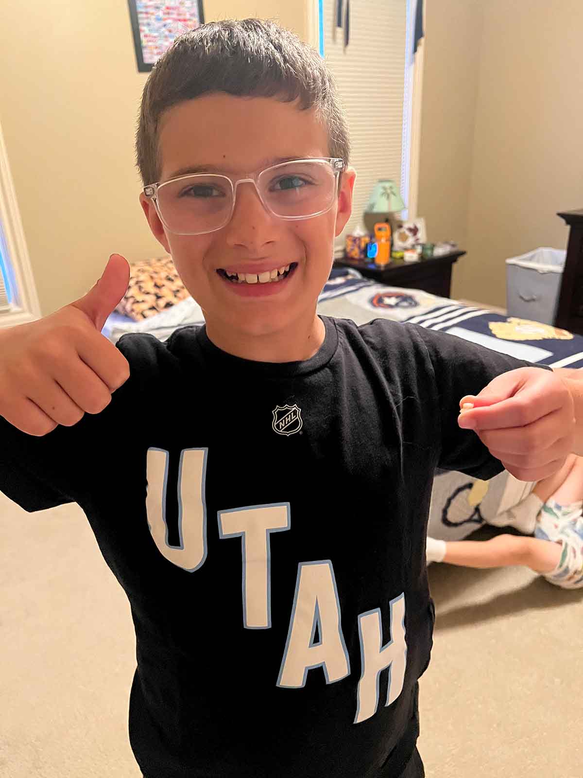Little boy holding a lost tooth and giving a thumbs up.